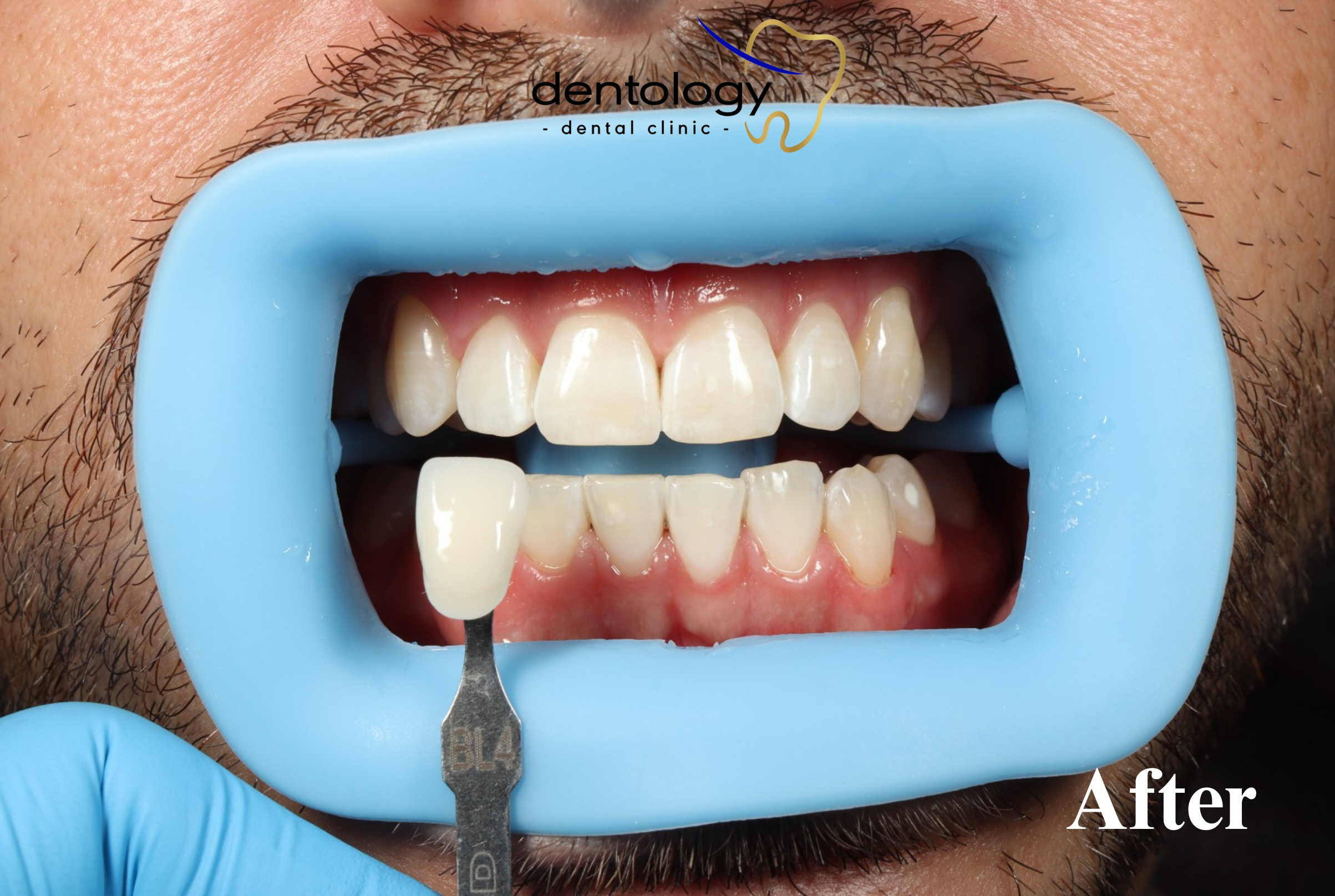 Aesthetic Dentistry dokter gigi denpasar