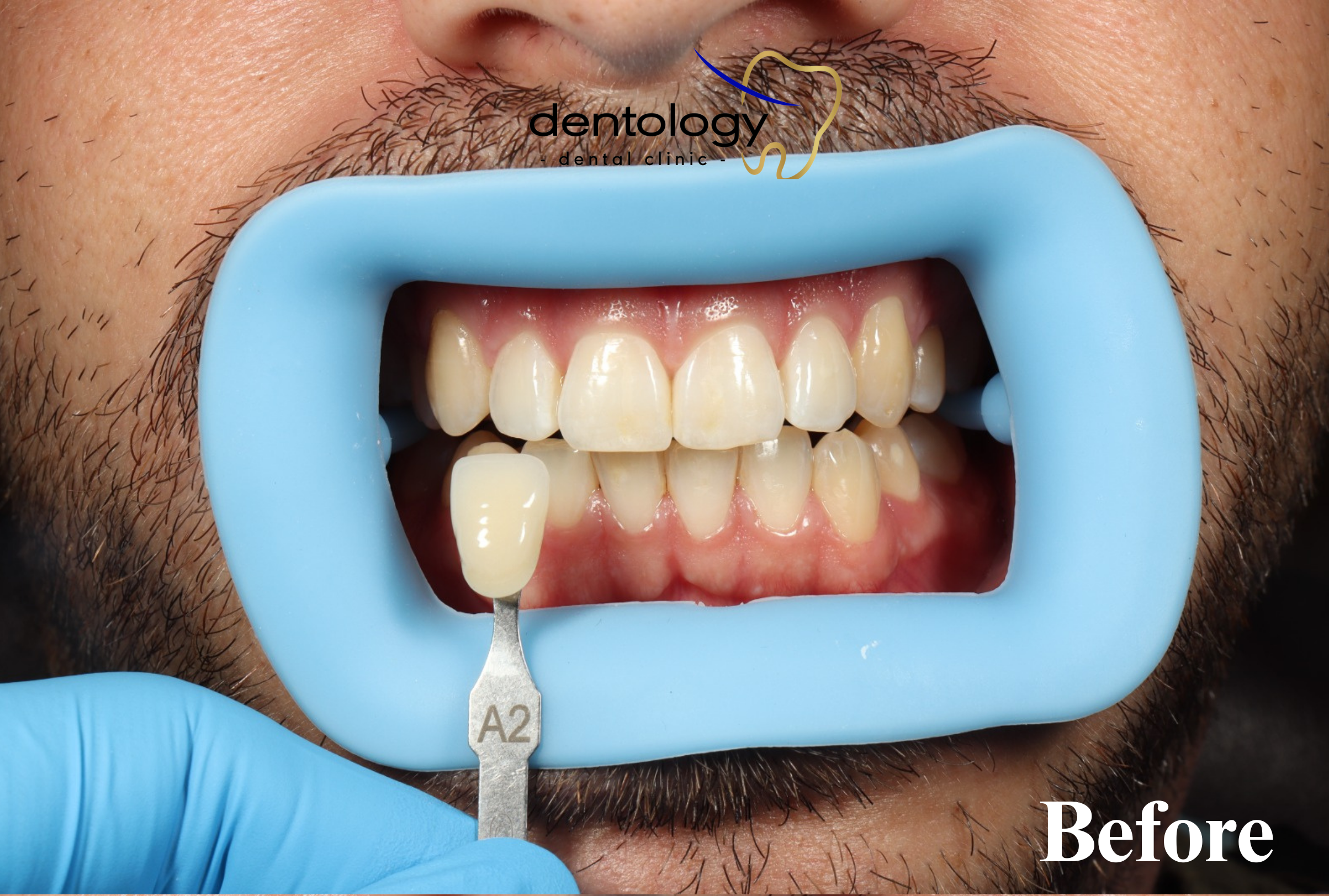 Aesthetic Dentistry dokter gigi denpasar